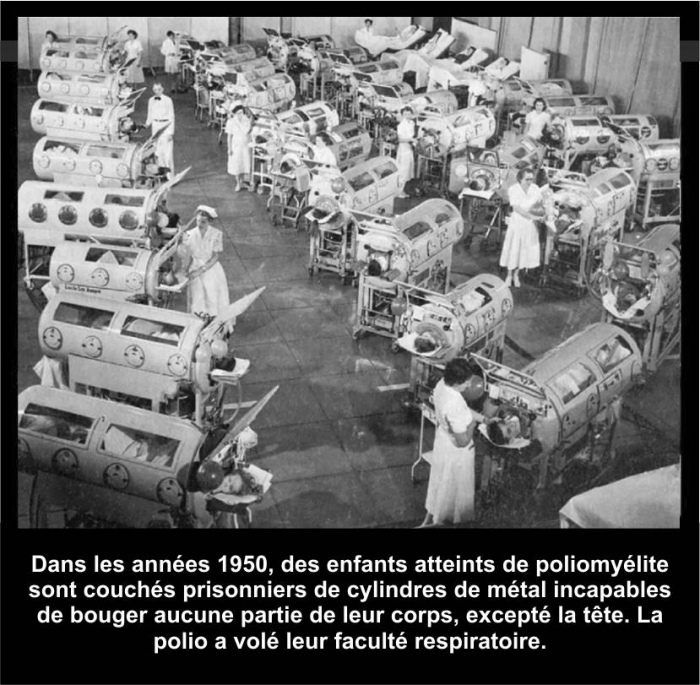 Les vraies causes de la polio ne sont pas reli�es � un soi-disant virus ou une autre forme de microbe