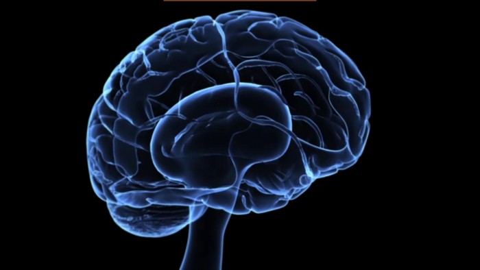 Il gu�rit son cancer terminal du cerveau gr�ce � des traitements alternatifs interdits